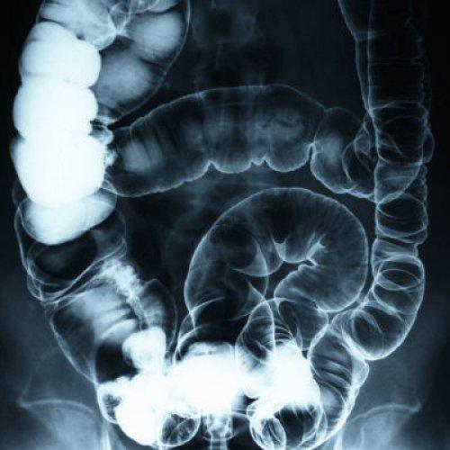 Xray of lower digestive system