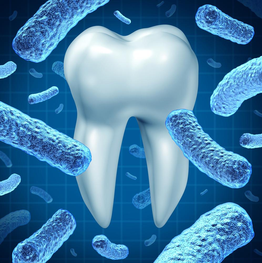 Bacteria - Oral/Periodontal (BAO)