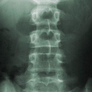 spinal column